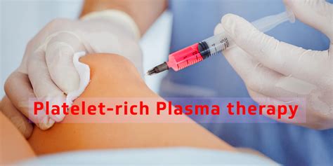 What Is Platelet-Rich Plasma Therapy? - ridesurfboard