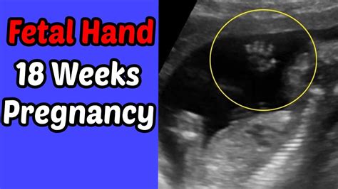 Fetal Hand 18 Weeks Pregnancy Youtube