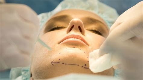 Genioplasty: Types, procedure, and recovery