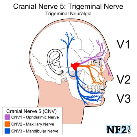 What Is The Trigeminal Ganglion - Margaret Greene Kapsels