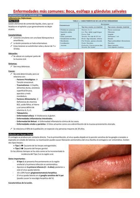 Prefacio identificación Travieso enfermedades cavidad oral arrastrar