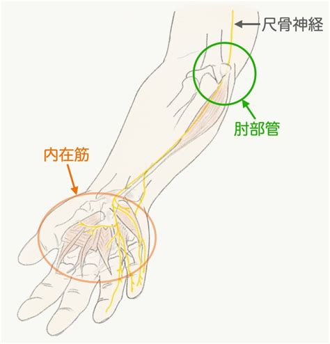 手がしびれる病気 〜肘部管症候群って何？〜｜まえだ整形外科・手のクリニック｜東京都杉並区にある手外科・整形外科