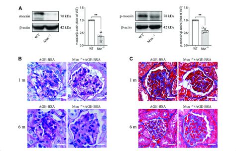 Moesin Deficiency Attenuated AGE BSA Induced Renal Fibrosis A