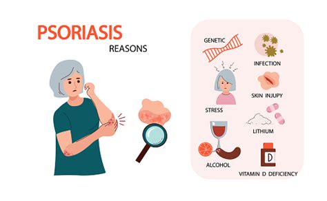 Psoriasis Symptoms And Reasons Infographic Human Skin Infection