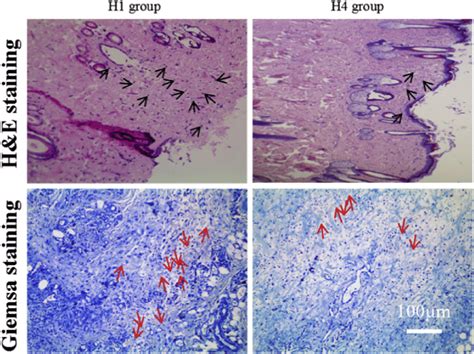 H E And Giemsa Staining Images Show Wound Infection Degree Of The