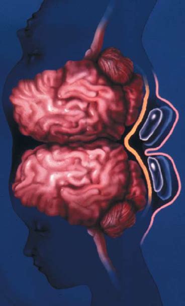 Position Of Tissue Expanders Download Scientific Diagram