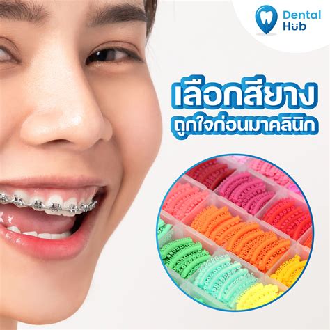 สียางจัดฟัน Dentalhubclinic