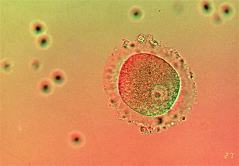 Lm Of Human Zygote After In Vitro Fertilisation By Cc Studioscience