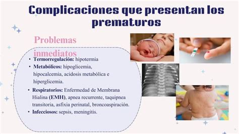 Prematuridad Test De Capurro En Neonatos Ppt Descarga Gratuita