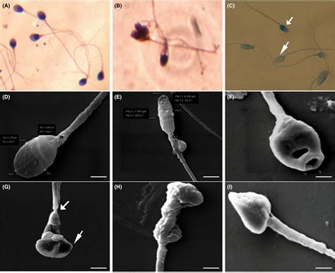 Human Sperm Under Microscope