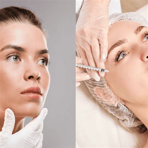 Botox Vs Dysport Injections Which One Is Right For You