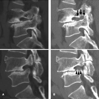 An Illustrative Case Of A Year Old Male Patient A Preoperative