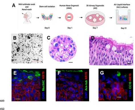 Figure Derivation And Characterization Of Human Nose Organoids Hnos