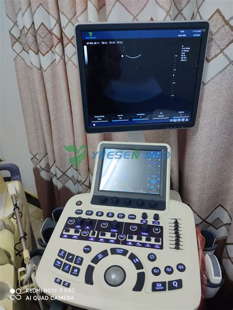 Trolley Color Doppler Ultrasound Ysb Q To Malawi