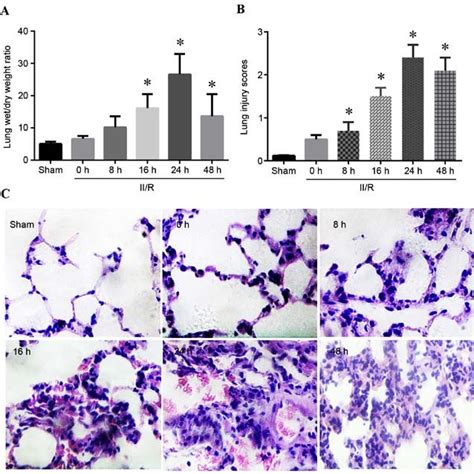 Assessment Of Lung Injury Following II R A Lung Wet Dry Weight Ratio