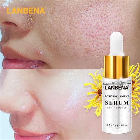 Jual LANBENA LB 10 PORE TREATMENT SERUM Shrink Pores Serum Pengecil