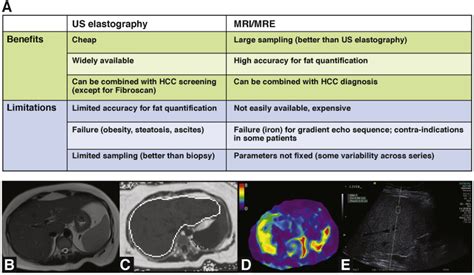 Magnetic Resonance Imaging Elastography Is Superior To Transient