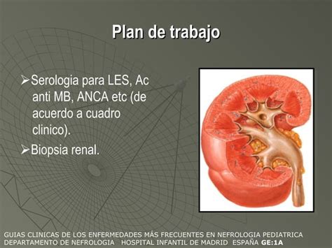 Sindrome Nefritico Ppt