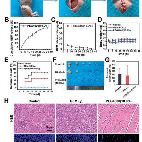 In Vivo Efficacy Evaluation Of Pllgapeg4000 100 Gem On Panc 1