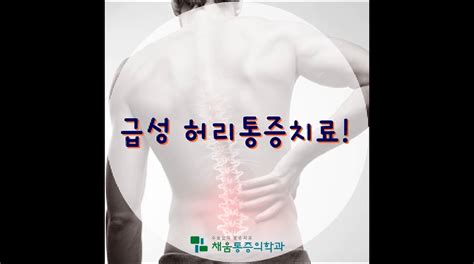 강동구정형외과 급성 허리통증 치료 갑자기 허리가 아파서 일상생활이 힘들어요