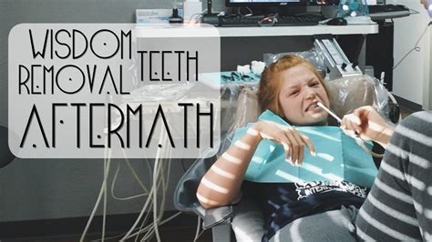 WISDOM TEETH REMOVAL AFTERMATH! - YouTube