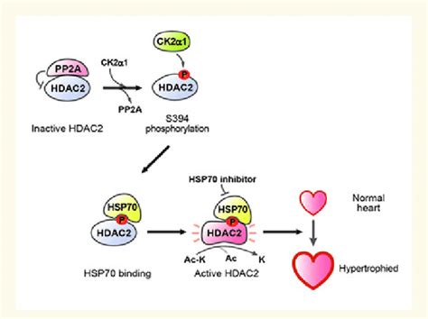 Diagram Hypertrophic Stress Induced Phosphorylation Of HDAC2 Enhances