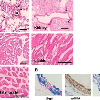 Analysis Of Tissues And Smooth Muscle Cells From Transgenic Mice A