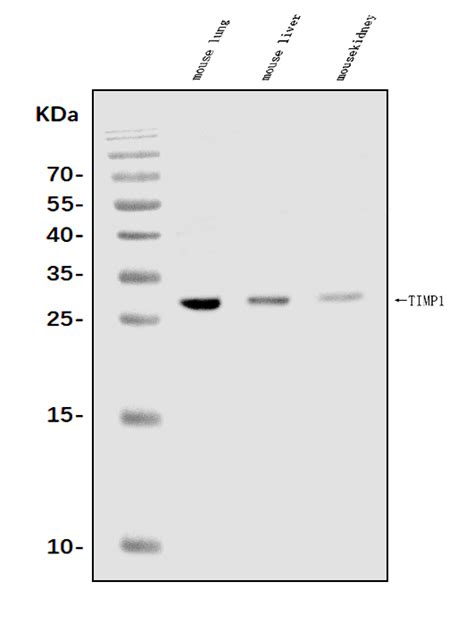 Anti Timp Antibody Picoband Bosterbio