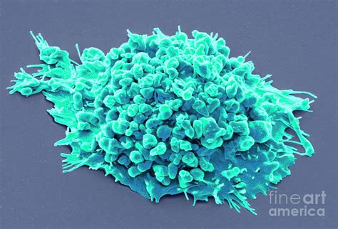 Lung Cancer Cell Photograph By Steve Gschmeissnerscience Photo Library