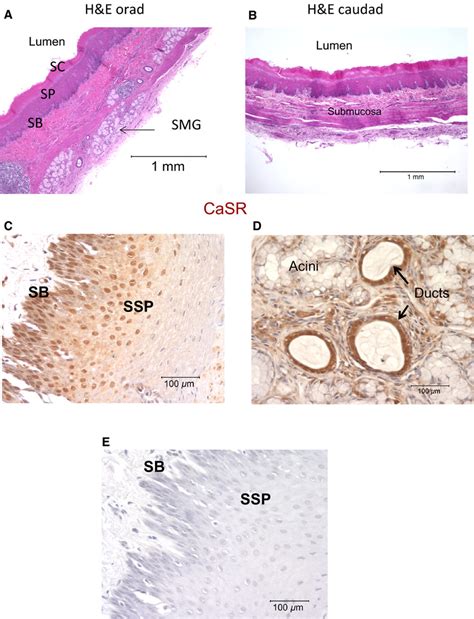 Esophageal Duct Histology