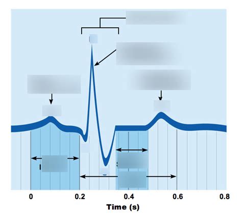 Ecg Labeling Diagram Quizlet