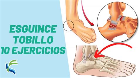 Ejercicios Para Curar El Esguince De Tobillo Fisioterapia