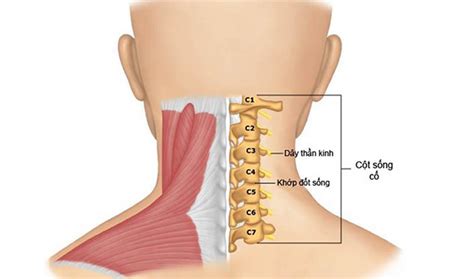 Bệnh Đau Đầu Vùng Chẩm Nguyên Nhân Biểu Hiện Cách Chữa MHRC