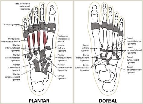 Metatarsal Fracture Management Orthopaedics And Trauma