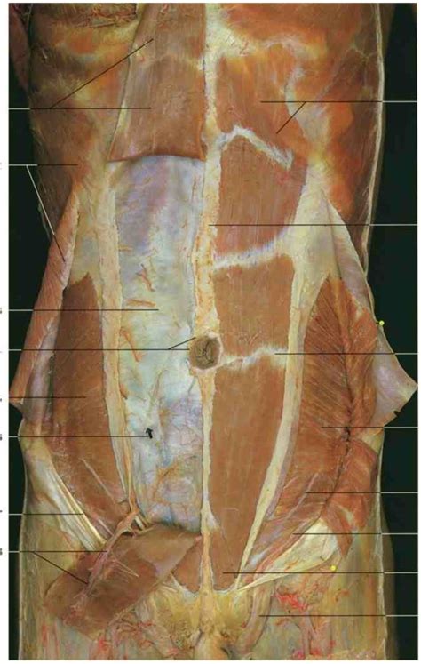 Rectus Sheath Cadaver