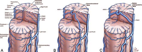 Artistic Representation Of The Normal Anatomy Of The Spinal Venous