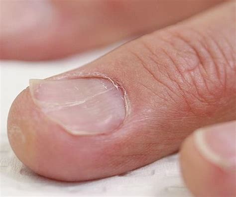 Australian Experts Reveal Common Nail Problems And What These Say About