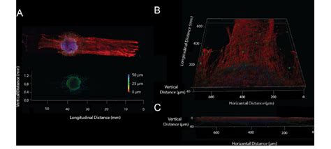 Drg Neurite Growth And Cell Migration In Dual Hydrogel Constructs Drg