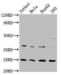 Anti Homo Sapiens Human Hamp Recombinant Monoclonal Antibody Cusabio