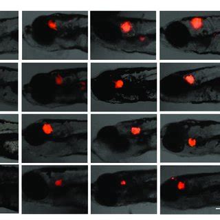 BKM120 Rucaparib Combination Treatment Inhibits Tumor Growth In The