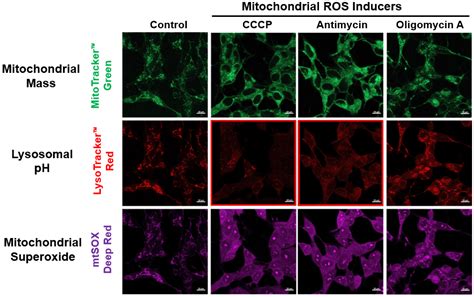 Associations Among Lysosomal Dysfunction Mitochondrial Dysfunction