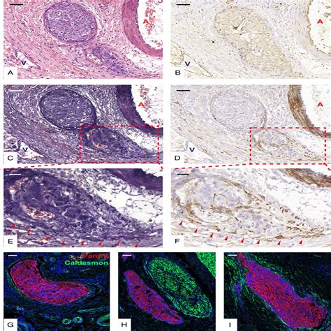 The American Journal Of Surgical Pathology