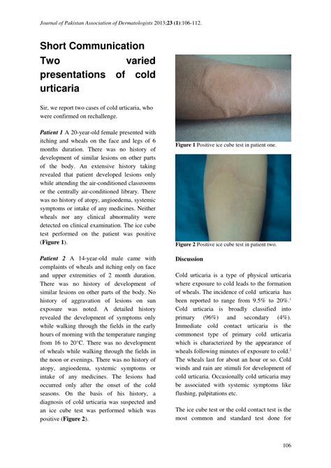 (PDF) Angiolymphoid hyperplasia jpad cs