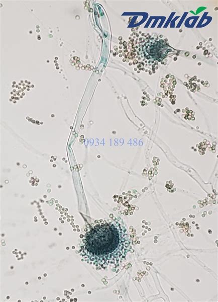 Ti U B N N M Aspergillus Fumigatus Dmk Lab