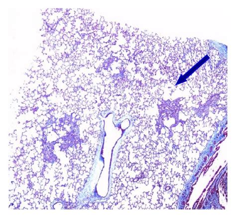 Photomicrographs Of Massons Trichrome Stained Lung Tissues From Each