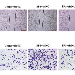 Sp Counteracted The Suppressive Effects Of Dancr Interference On