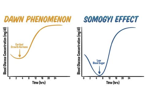 Unveiling the Differences: The Dawn Phenomenon vs. The Somogyi Effect ...