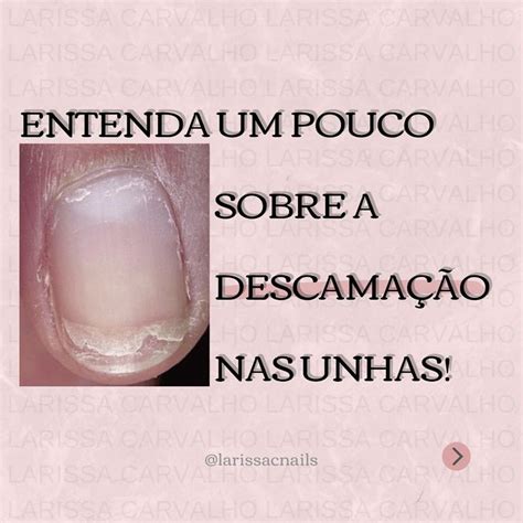 Larissa Carvalho Nail Designer no Instagram O que será a descamação