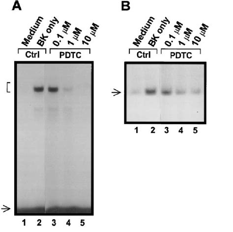 Inhibition Of Bk Induced Nf B Activation And Il Message By Pdtc