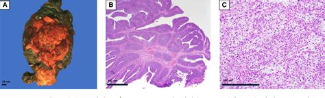 Figure From Tumor Immune Microenvironment Revealed By Imaging Mass